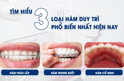 Bí Quyết Duy Trì Nụ Cười Hoàn Hảo: Tìm Hiểu Về 3 Loại Hàm Duy Trì Phổ Biến